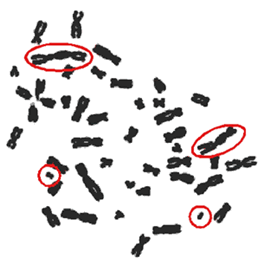 Радиационное поражение (красным кружком обведены хромосомные аномалии маркеры радиационного поражения клетки )